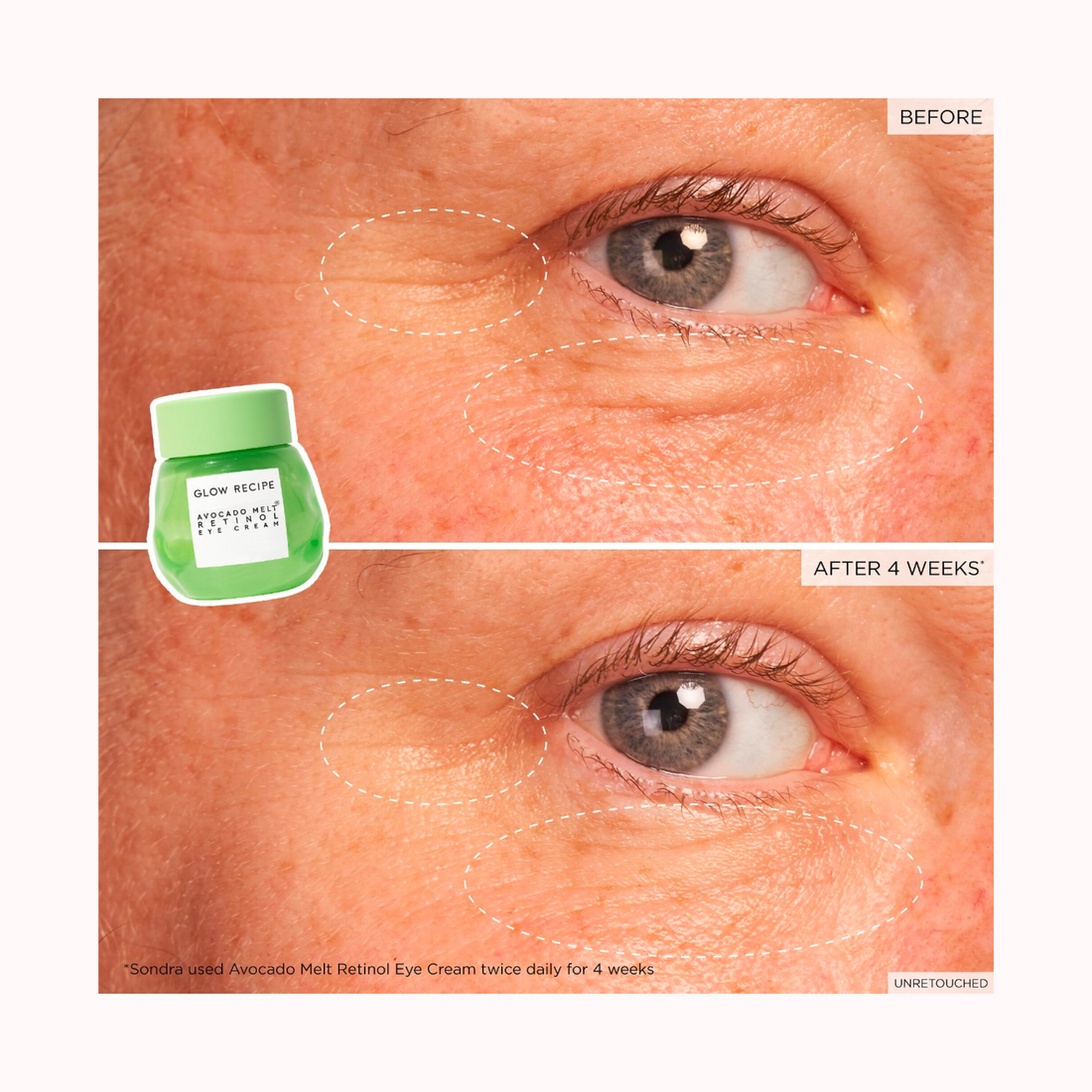 Avocado Melt  Eye Cream with Retinol