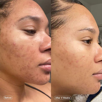 Topicals Faded Brightening Serum